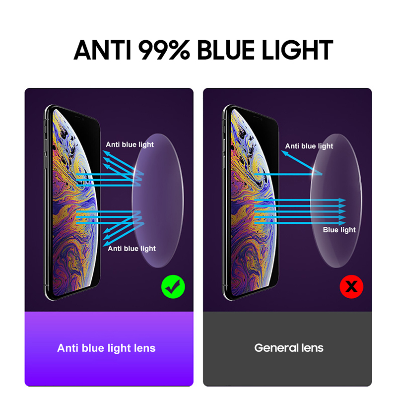 2026 Renkli Kadın Kare Anti Ma - Unique Lighting Decor incelemesi ve fiyatı